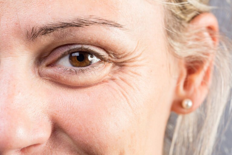 كيف-تكشف-تجاعيد-العينين-أسرار-صحة-الدماغ.jpg