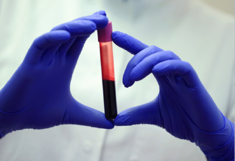 ثورة-طبية-جديدة-فحص-دم-بسيط-يتنبأ-بمن-سيعيش-لفترة.png