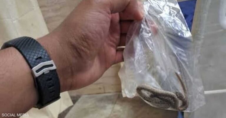 تصرف-غريب-من-مصاب-يفتح-ملف-لدغات-الأفاعي-في-مصر.jpeg