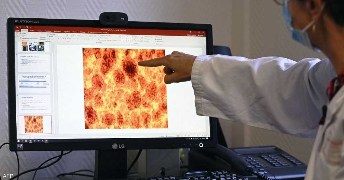حبوب-جديدة-تضاعف-متوسط-البقاء-في-سرطان-البنكرياس.jpg