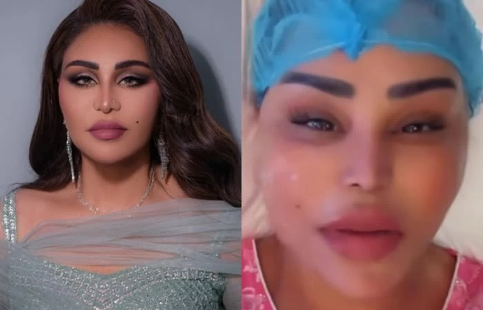 أحلام-تكشف-تفاصيل-إجراء-تجميلي-جديد-لشد-الوجه-أخبار.webp.webp